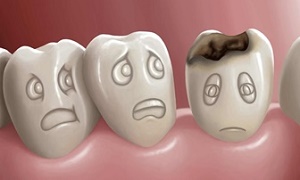 دندانپزشکی پیشگیری